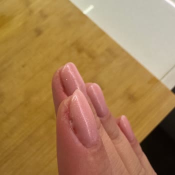 Hijyen Sorunu Ve Kötü Manikür Deneyimi