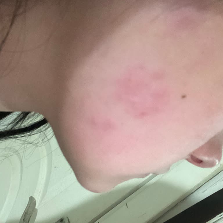 Ciltte Beklenmedik Reaksiyon: Collagen Night Mask