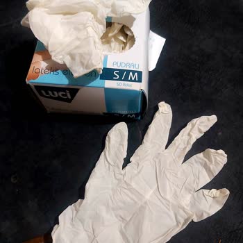 Yanlış Beden Eldiven Sorunu Ve Değişim Talebi