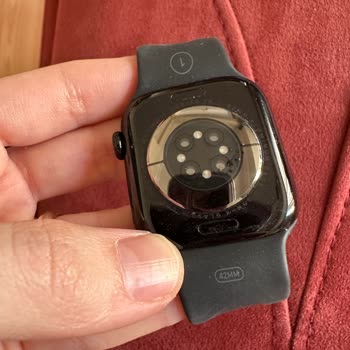 Watch 10 Kayışı Egzama Yaptı: Acil Çözüm Bekliyorum