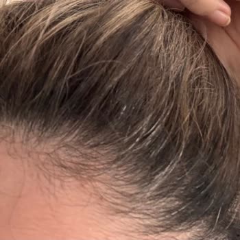 Yunus Kaplan - Naturel Hair Design Pişmanlığı