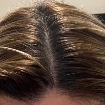 Yunus Kaplan - Naturel Hair Design Pişmanlığı