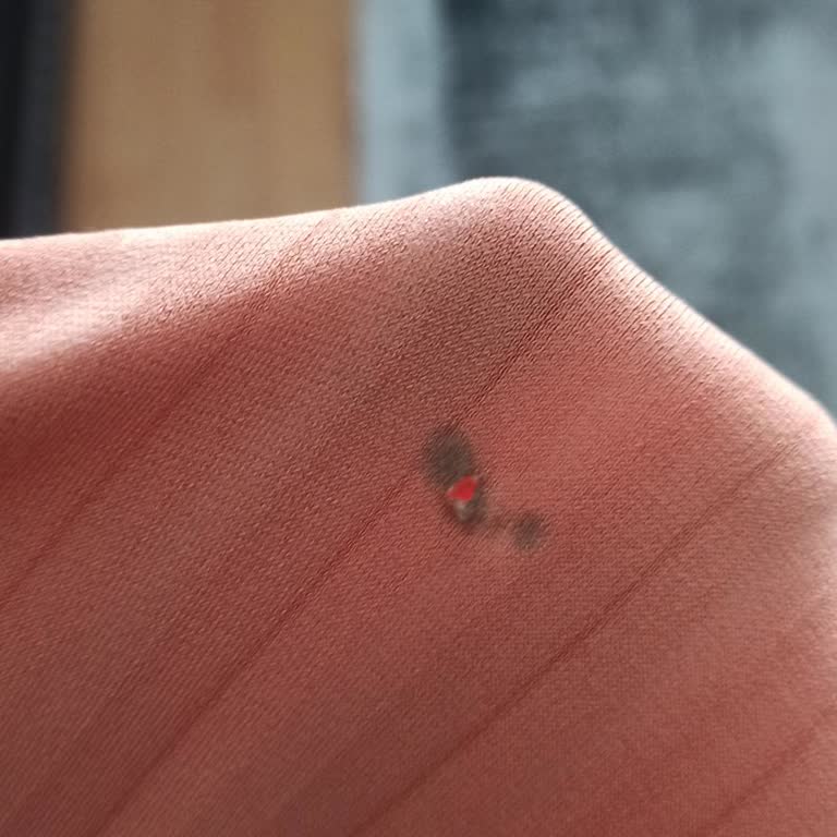 Butik Miram'dan Gelen Defolu Elbise Ve Cevapsız Mesajlar