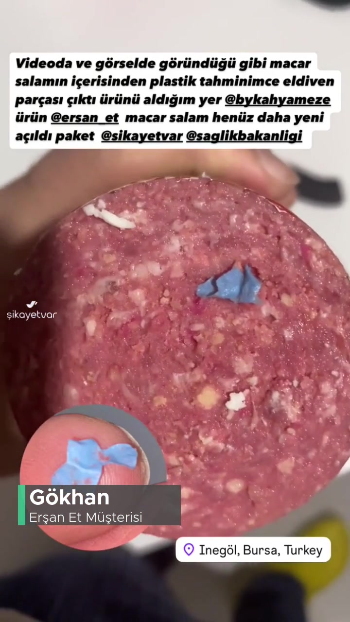 Erşan Salamdaki Yabancı Madde! videonun kapak resmi