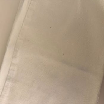 Havoş Lekeli Ürün Ve Yanlış Fatura: Trendyol'dan İade Sorunu