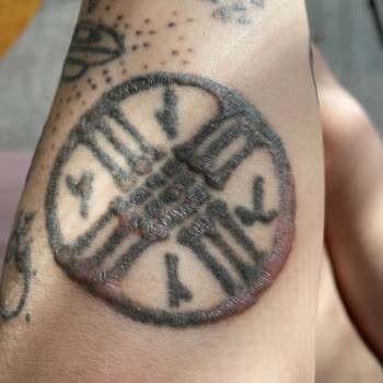 Dövme Sildirme Yanıkları: Beklenmedik Sonuçlar