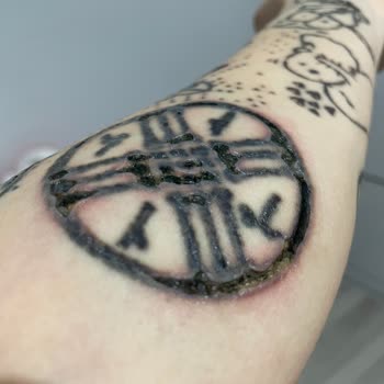 Dövme Sildirme Yanıkları: Beklenmedik Sonuçlar