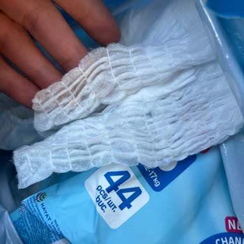 Molfix Ve Ebebek'te Hayal Kırıklığı: Defolu Ürün Ve Yetersiz Müşteri Hizmeti