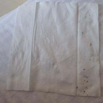 Küf Lekeli Temizlik Havlusu Şoku