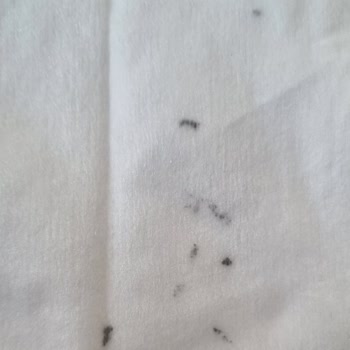 Küf Lekeli Temizlik Havlusu Şoku