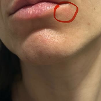 Yves Rocher Ürünleri Beklenmedik Alerjik Reaksiyonlara Sebep Oldu!