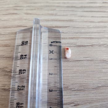 Maret Dana Kasap Sucuk İçinden Çıkan Kemik Tehlikesi