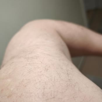 Aris Güzellik Merkezleri Epilasyon Hizmetinde Hayal Kırıklığı Ve Müşteri Memnuniyetsizliği