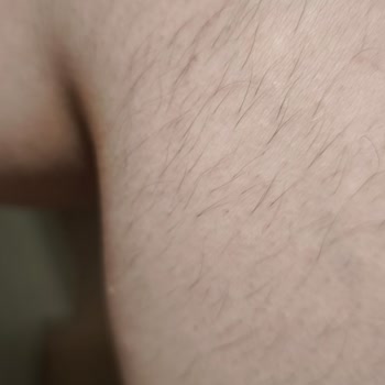 Aris Güzellik Merkezleri Epilasyon Hizmetinde Hayal Kırıklığı Ve Müşteri Memnuniyetsizliği