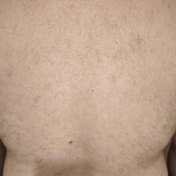 Aris Güzellik Merkezleri Epilasyon Hizmetinde Hayal Kırıklığı Ve Müşteri Memnuniyetsizliği