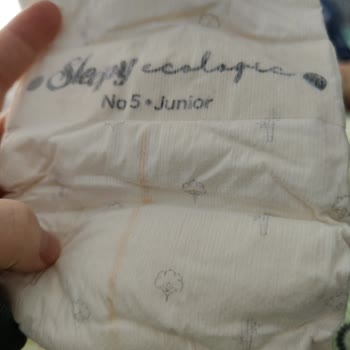 Bebek Bezi Kabusu: Alerji Ve Sızdırma Sorunları