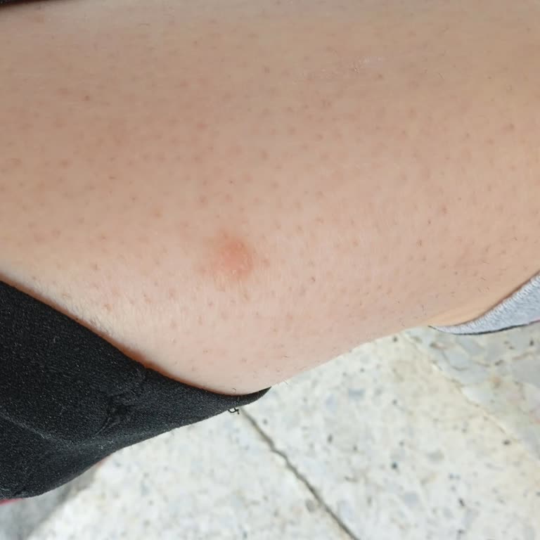 Güzellik Merkezinde Hayal Kırıklığı Ve Mağduriyet