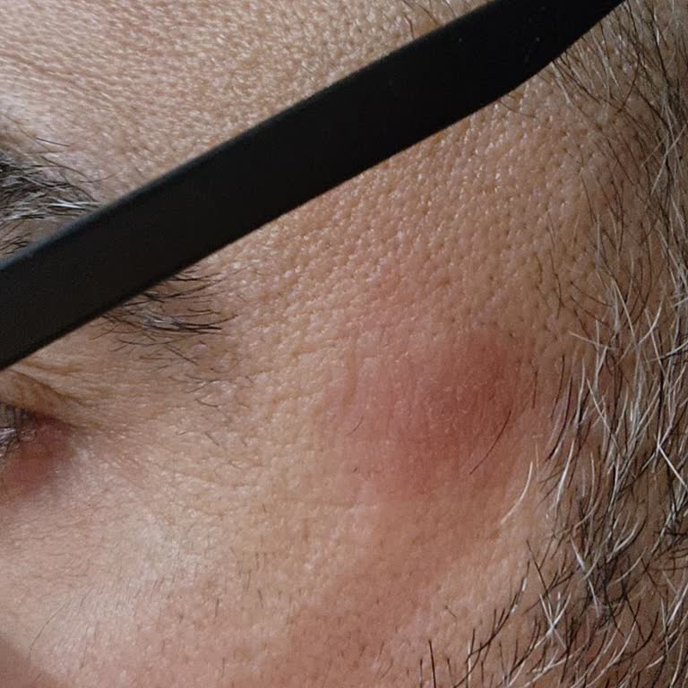 Gözlük Kullanımında Sağlık Sorunu Ve Müşteri Hizmetleri İlgisizliği