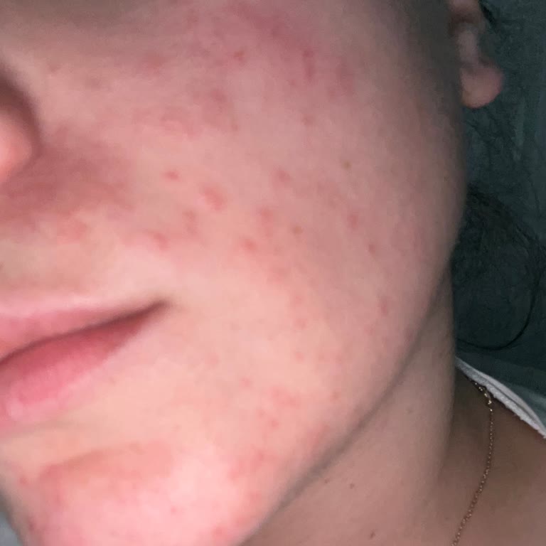 Garnier Yüz Maskesi Cildimi Tanınmaz Hale Getirdi