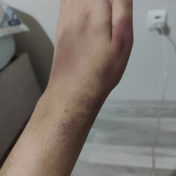 İlhan Özdemir Hastanesi Kan Alma İşleminde Yaşanan Sorun Ve Sonuçları