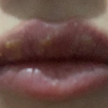 Flormar Dudak Ürününden Kaynaklanan Ciddi Sorunlar