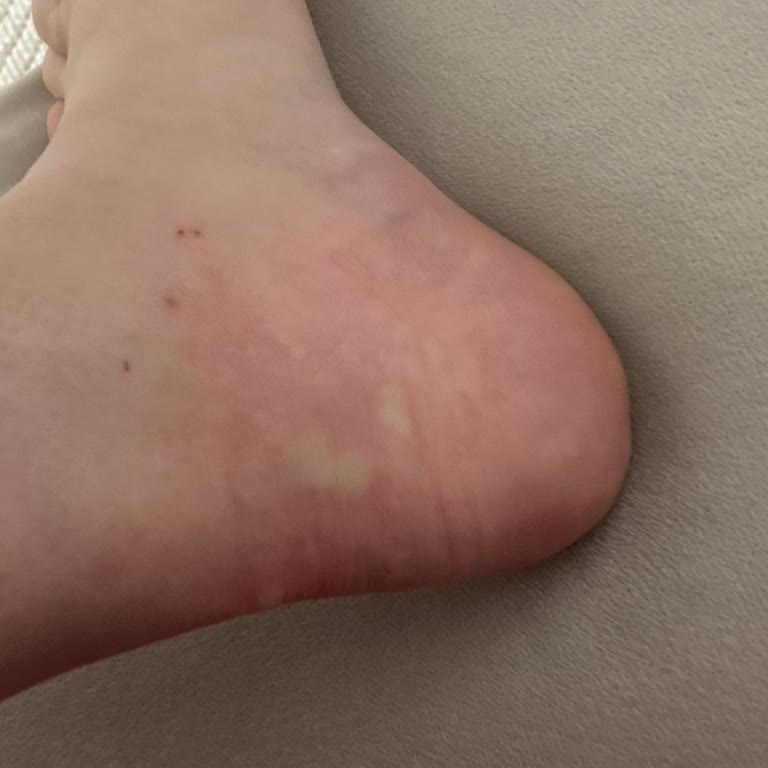 Alerjik Reaksiyon Ve Kötü Koku Şoku: Hamilelikte Deterjan Kabusu