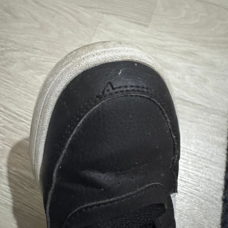 Adidas Ayakkabının Dikiş Problemi Ve Garanti Sorunu