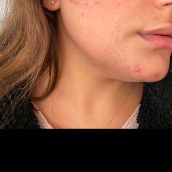 As Aksis Güzellik Salonu Bahçelievler Şikayeti