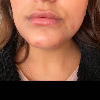 As Aksis Güzellik Salonu Bahçelievler Şikayeti