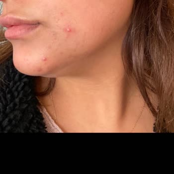 As Aksis Güzellik Salonu Bahçelievler Şikayeti