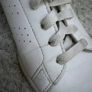 Adidas Ayakkabıda Deri Çatlaması Sorunu