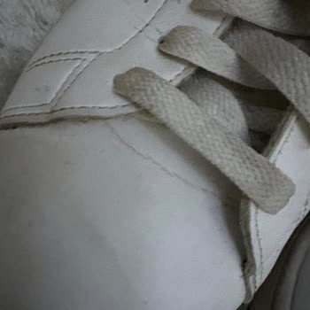 Adidas Ayakkabıda Deri Çatlaması Sorunu