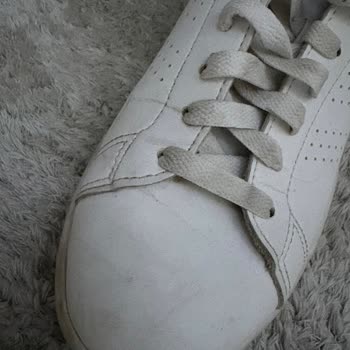 Adidas Ayakkabıda Deri Çatlaması Sorunu