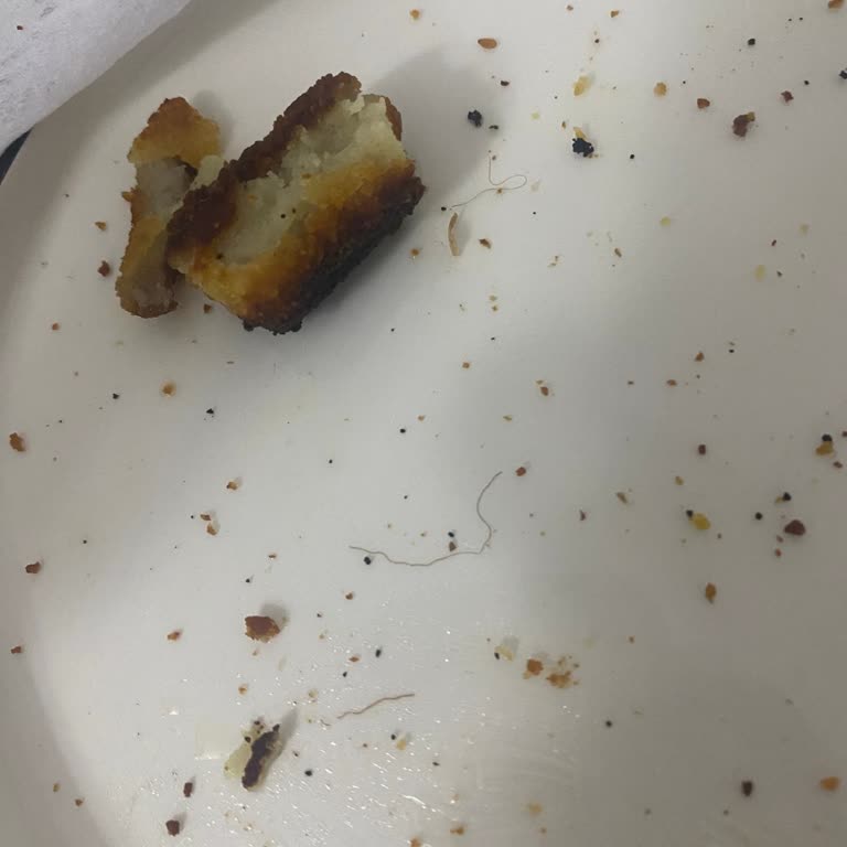 Superfresh Patates Kroket İçinde Kıl Şoku