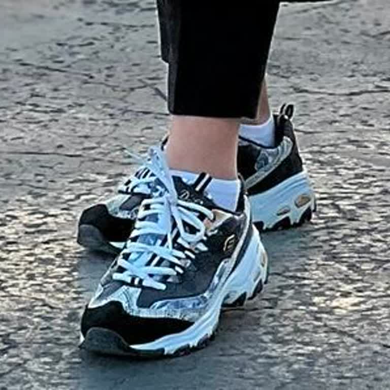 Skechers Ayakkabı Sorunu: Sürekli Mağduriyet Ve Çözüm Eksikliği