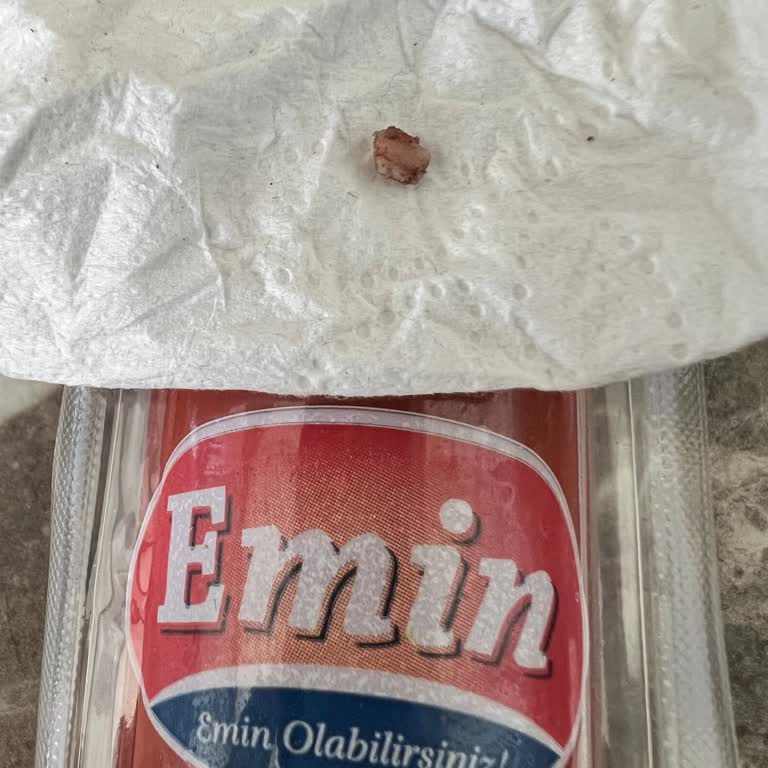 BİM Ürünlerinde Sürekli Kemik Sorunu