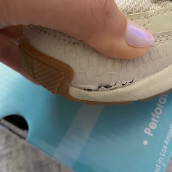 Skechers Ayakkabı Hayal Kırıklığı: Patlayan Sol Ön Kısım
