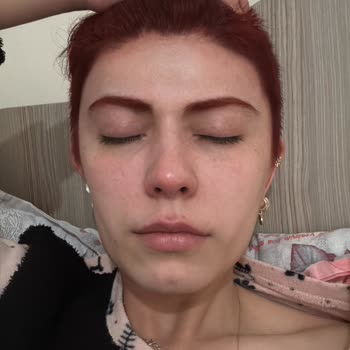 Saç Boyası Alerjisi Ve Yan Etkileri