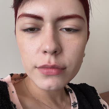 Saç Boyası Alerjisi Ve Yan Etkileri