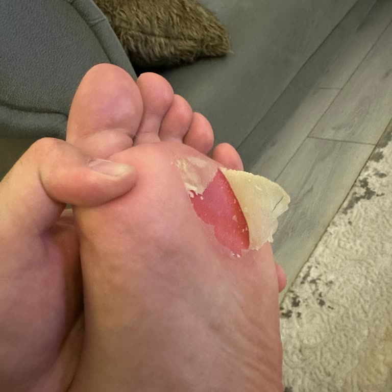 Problemas con zapatos Skechers, incomodidad y baja calidad