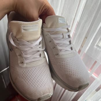 Skechers Ayakkabıda Sararma Sorunu Ve İletişim Zorluğu