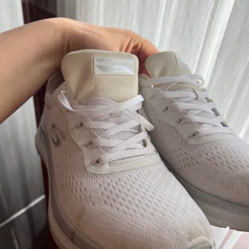 Skechers Ayakkabıda Sararma Sorunu Ve İletişim Zorluğu