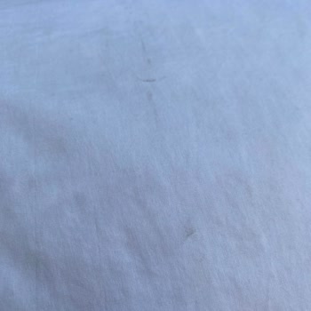 Dry Clean Express Kuru Temizleme Fiyaskosu: Kaz Tüyü Yastık Sorunu