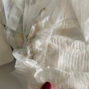 Molfix Bebek Bezinde Hijyen Sorunu Ve Güven Kaybı