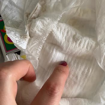 Molfix Bebek Bezinde Hijyen Sorunu Ve Güven Kaybı