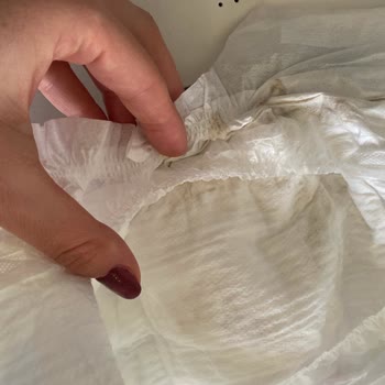 Molfix Bebek Bezinde Hijyen Sorunu Ve Güven Kaybı