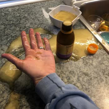 Argivit Smart Şişesi Patladı Ve Köpürdü