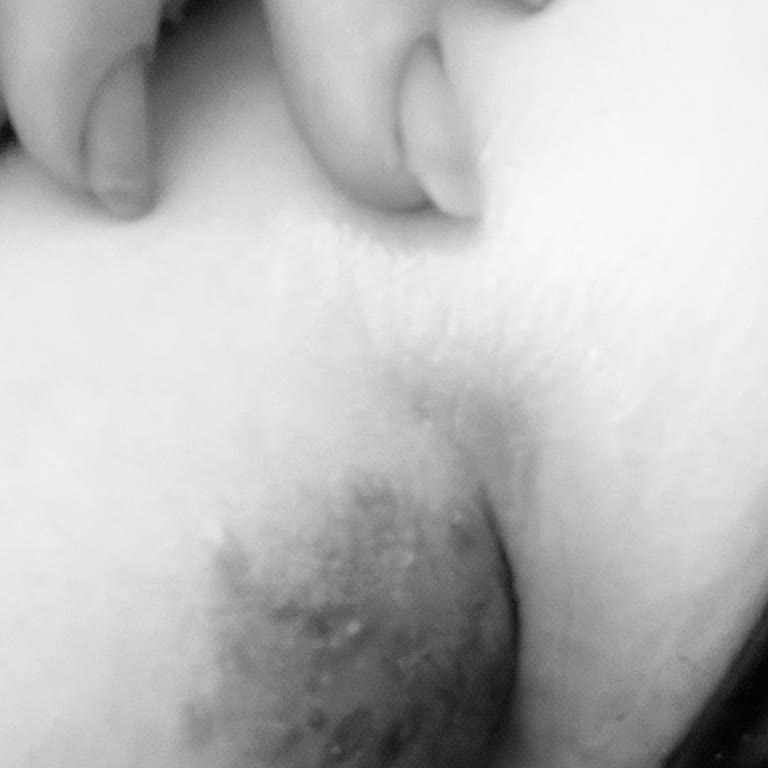 Cilt Sağlığını Tehdit Eden Sprey