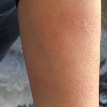 Alerji Yapan Parfüm Kabusu