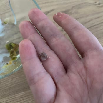 Baklavanın İçinden Çıkan Taşla Şok Olduk